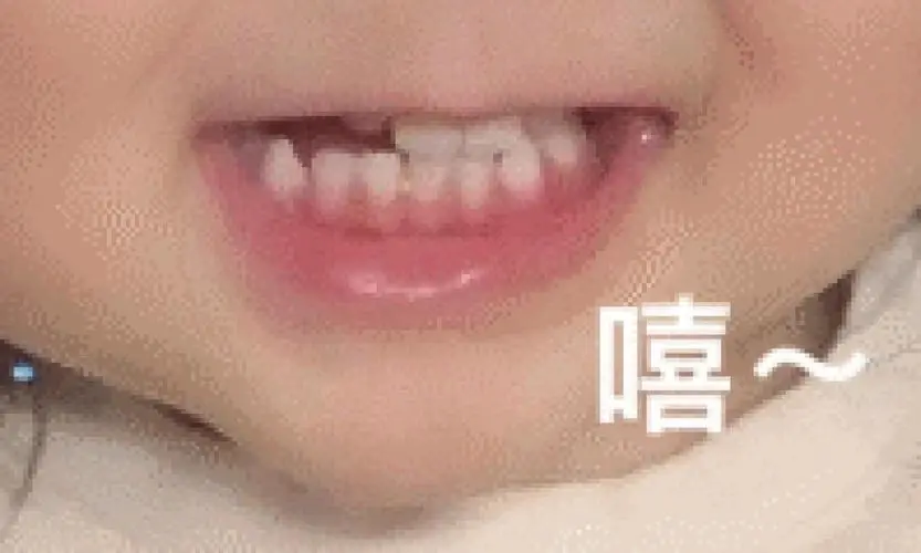 一个小朋友龇牙嘻的表情包已找到